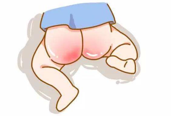 宝宝红屁股怎么快速解决