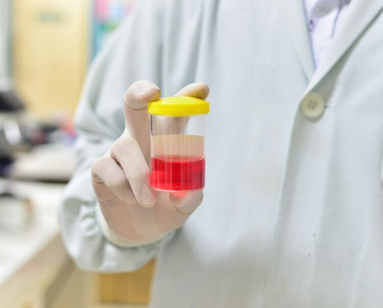 睡前总想上厕所,是肾有问题还是心理有问题?看看科学的解释