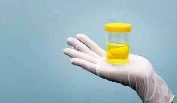 被忽视的尿液,竟是健康的“信号灯”!上完厕所记得回头看一眼