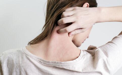 女性湿疹症状图片 女性湿疹症状 女性湿疹都有哪些症状