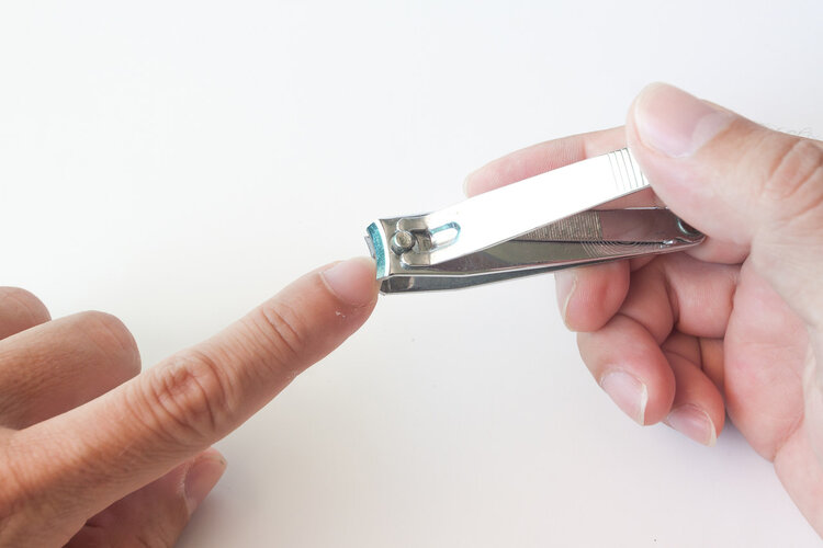 肾脏好不好,看指甲就知道?指甲长成这3个样子,早点排查肾病