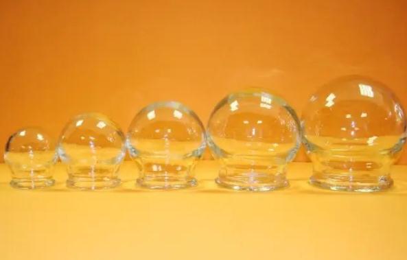 肚子拔罐能减肥吗?拔罐减肥拔哪些部位?