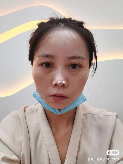 女人如何保养卵巢 美丽是保养出来的
