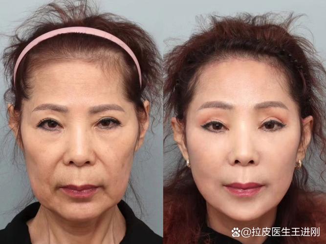 女子开远光被邻居闪灯提醒后破防 引发社会关注 女子开远光被邻居闪灯提醒后破防 引发社会关注