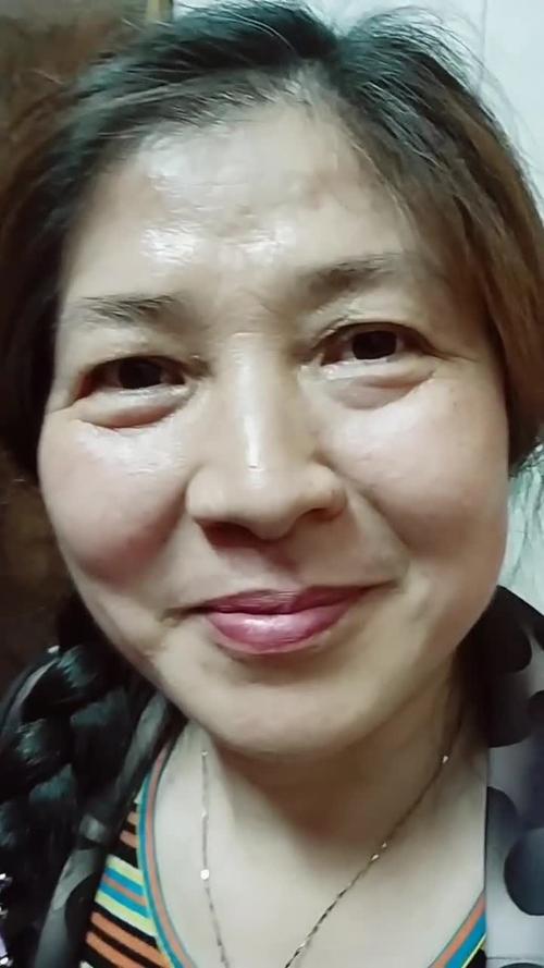 下巴硬疙瘩频发方案 原因分析及应对方法 下巴硬疙瘩频发方案 原因分析及应对方法