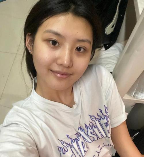 牙齿根管治疗疼吗 轻微疼痛是正常反应 牙齿根管治疗疼吗 轻微疼痛是正常反应