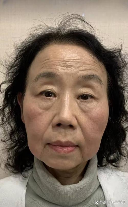 中药大黄的功效与作用 介绍大黄的三大功效