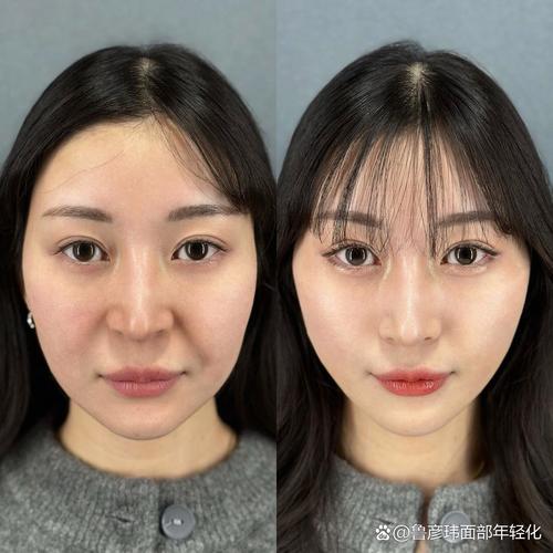 青霉素过敏了怎么办 及时处理很重要