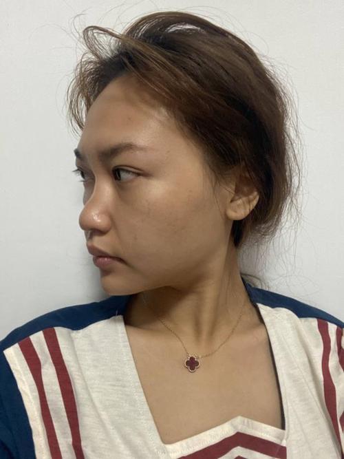 宫外孕注意事项有哪些  意外妊娠健康必备指南