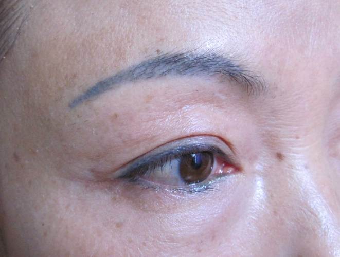 弯腰驼背怎么办 五招还您一个完美身形