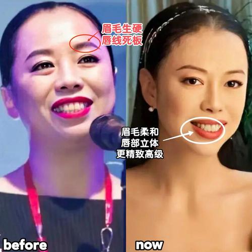 普瑞丁左旋肉碱减肥效果 服用普瑞丁左旋肉碱还有其他功效