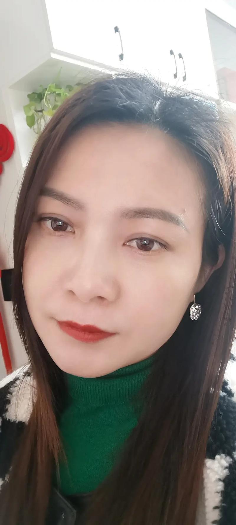 男性脱发会遗传吗 小心遗传给宝宝