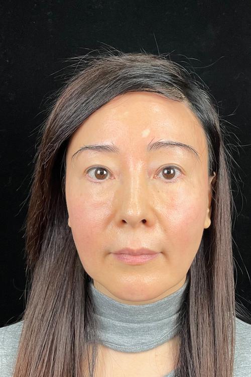 晚上吃花生会胖吗 晚上适量吃花生不会发胖 晚上吃花生会胖吗 晚上适量吃花生不会发胖