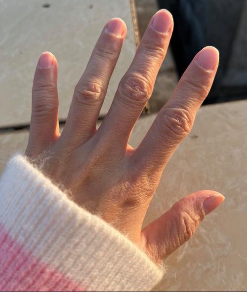 血脂稠吃什么药