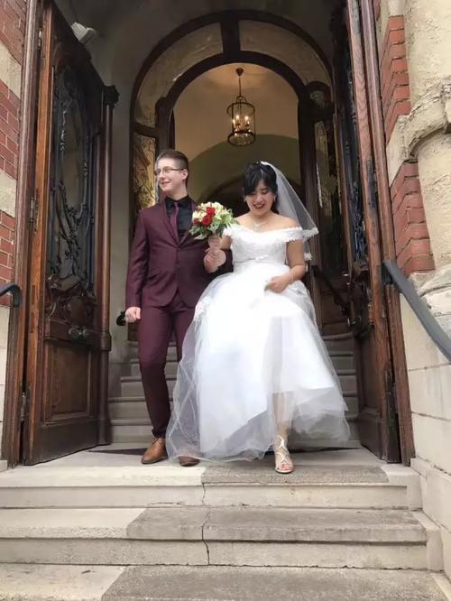 脸上毛孔粗大怎么办 爱美人士必修知识