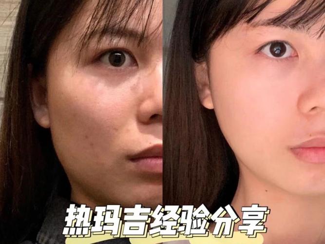 脸上长黄褐斑怎么调理呢 五步还你黄花净爽皮肤