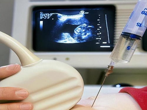 宋楼钟点工钟点工老宋免费阅读