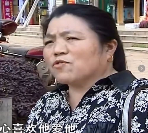 吸烟可加速肝脏的纤维化